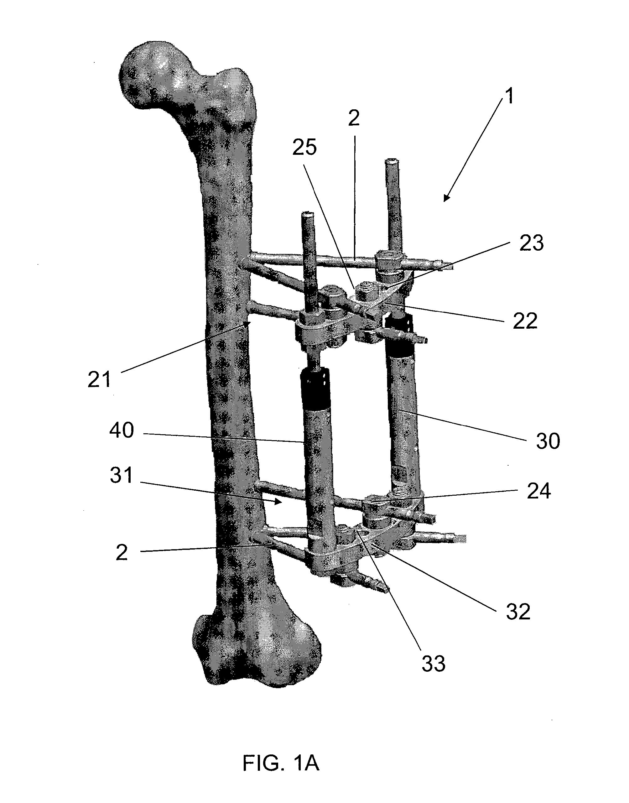 Elongated pin for an external modular fixation system for temporary and/or permanent fixation applications and external modular fixation system