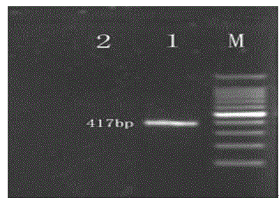 Hantavirus integrated nucleic acid detection kit and detection method