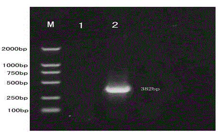 Hantavirus integrated nucleic acid detection kit and detection method