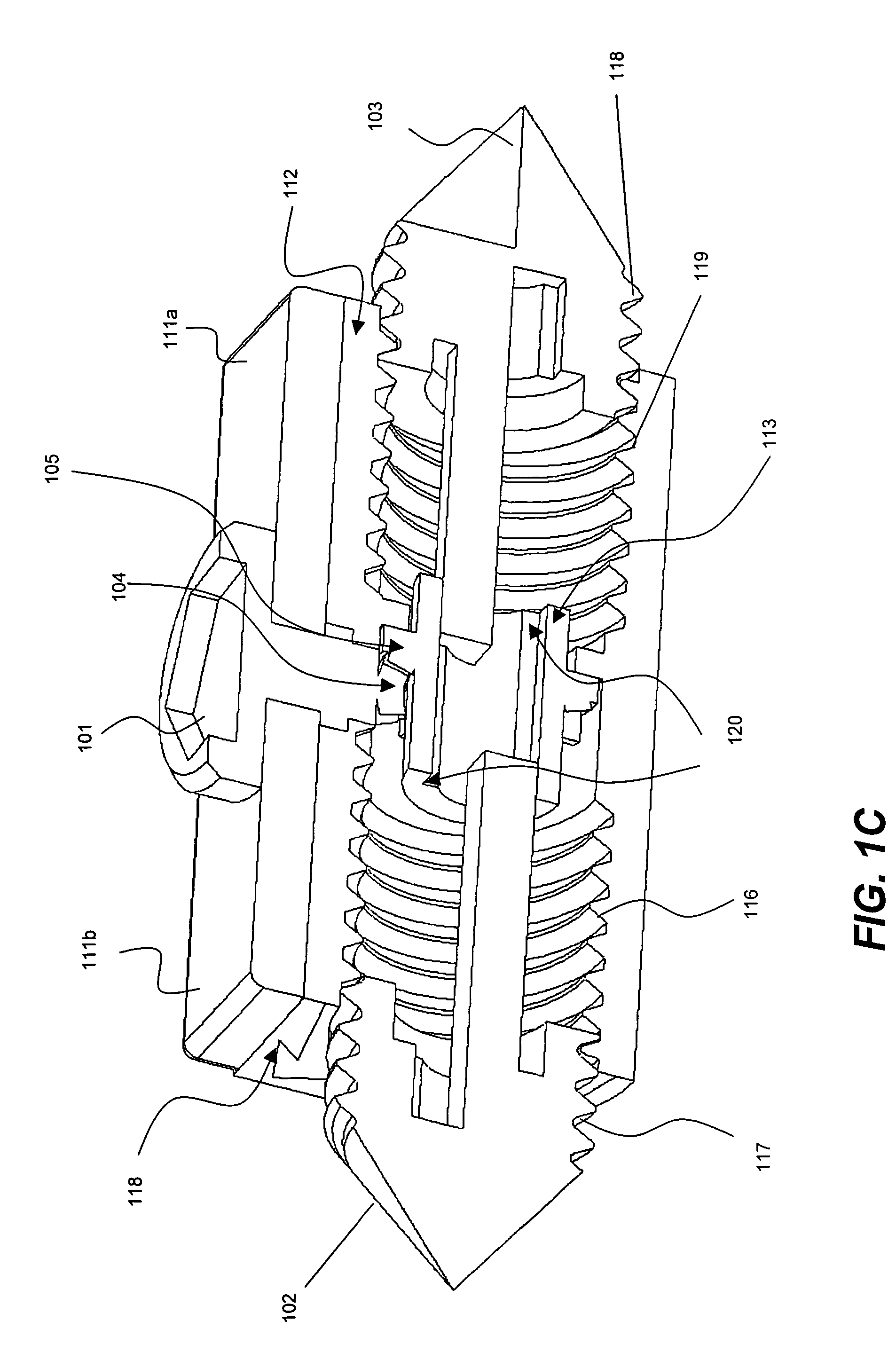 Bi-directional fixating transvertebral body screws, zero-profile horizontal intervertebral miniplates, expansile intervertebral body fusion devices, and posterior motion-calibrating interarticulating joint stapling device for spinal fusion