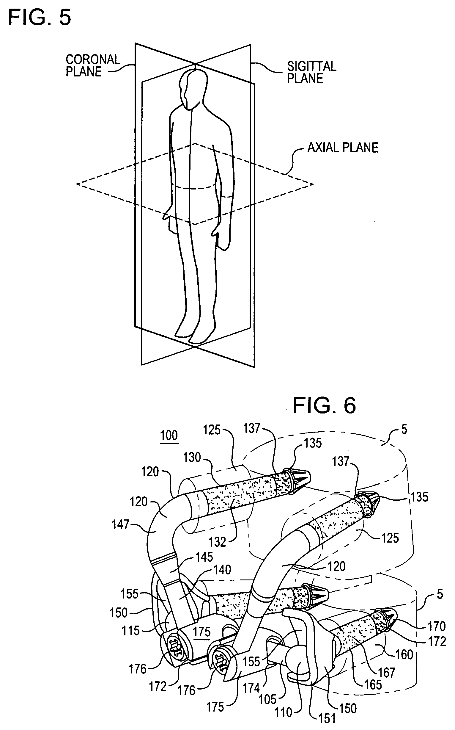 Crossbar spinal prosthesis having a modular design and related implantation methods