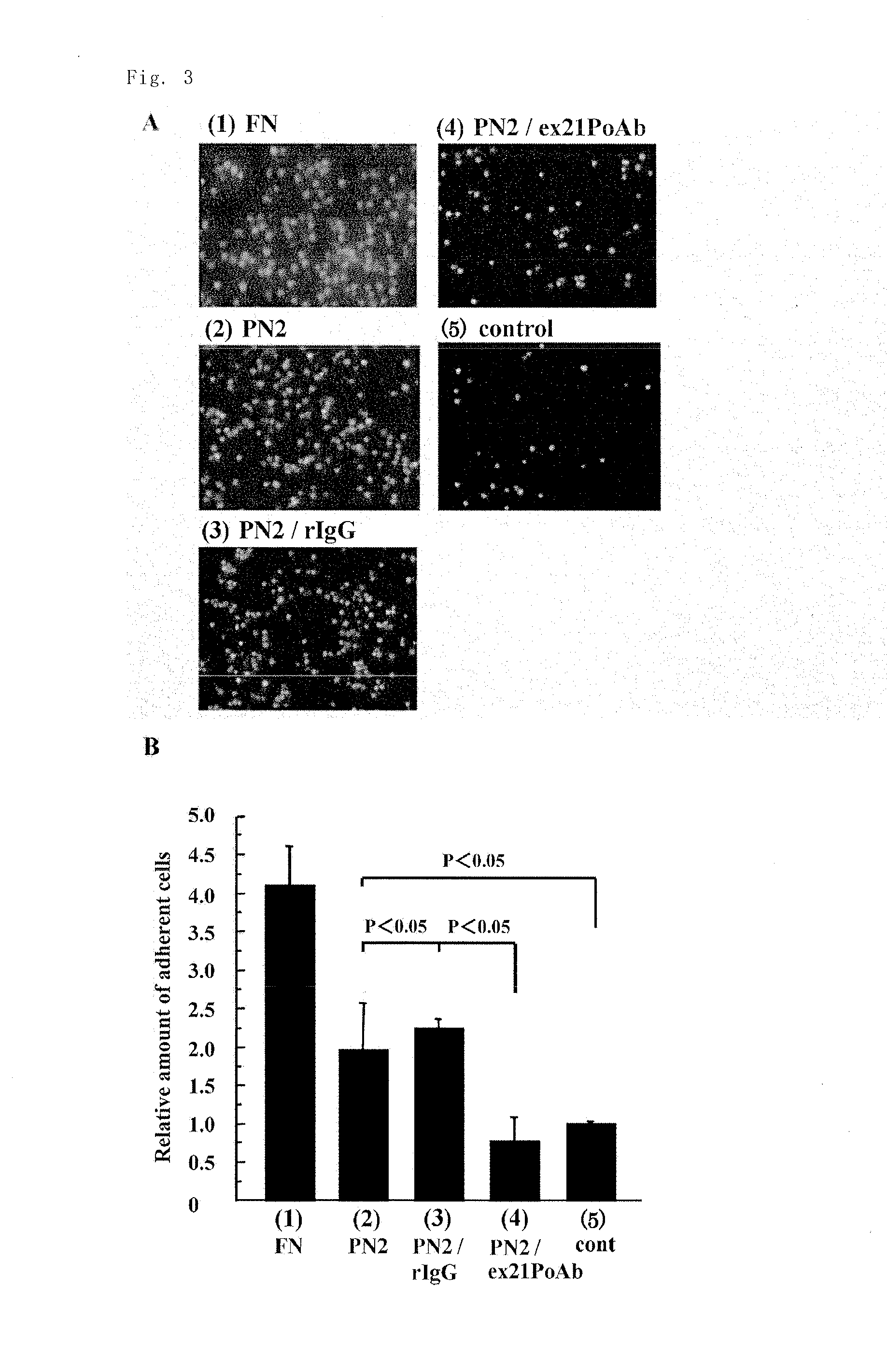 ANTIBODY TO PEPTIDE ENCODED BY Exon-21 OF PERIOSTIN, AND PHARMACEUTICAL COMPOSITION FOR PREVENTION OR TREATMENT OF INFLAMMATORY DISEASE CONTAINING SAID ANTIBODY