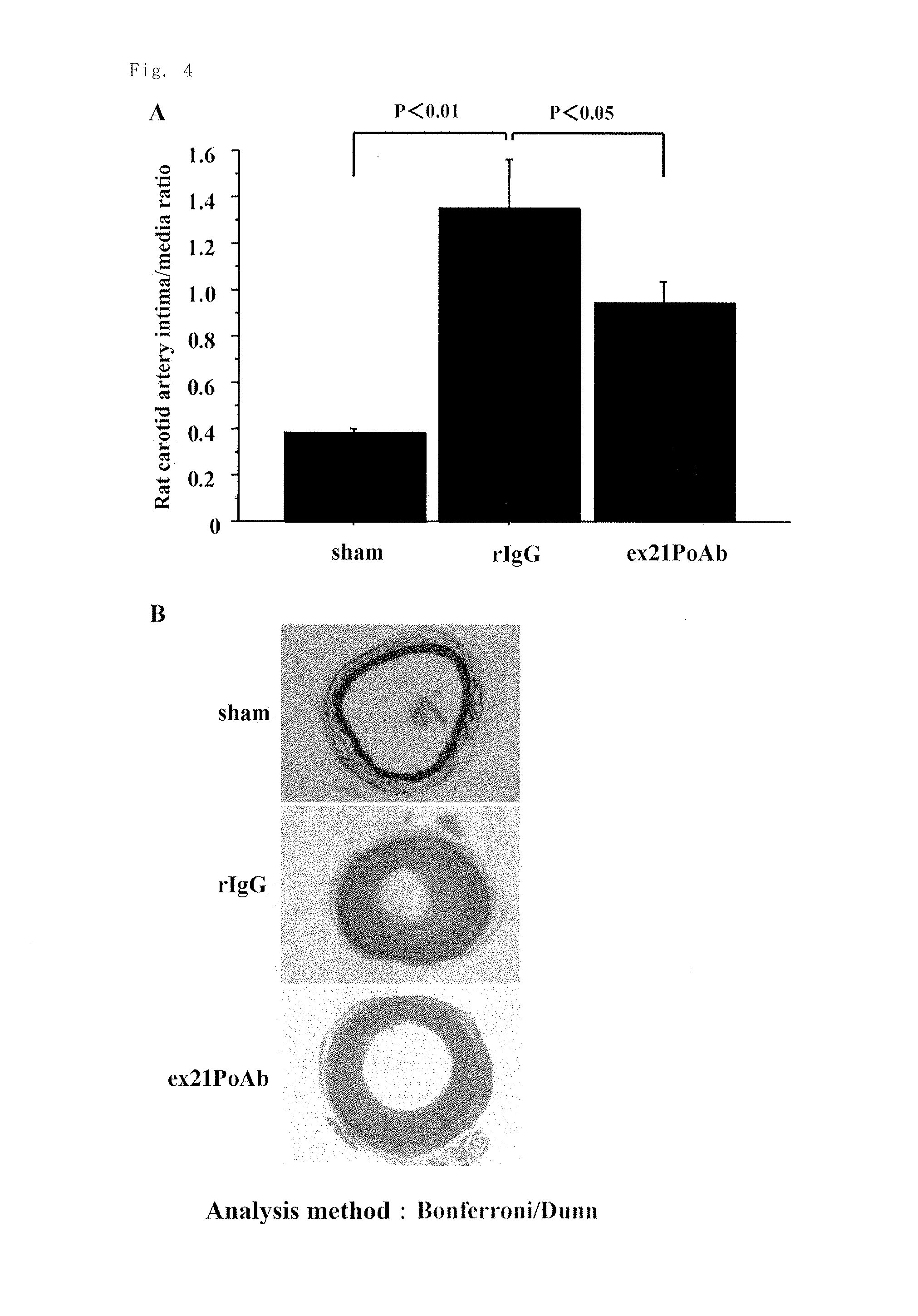 ANTIBODY TO PEPTIDE ENCODED BY Exon-21 OF PERIOSTIN, AND PHARMACEUTICAL COMPOSITION FOR PREVENTION OR TREATMENT OF INFLAMMATORY DISEASE CONTAINING SAID ANTIBODY