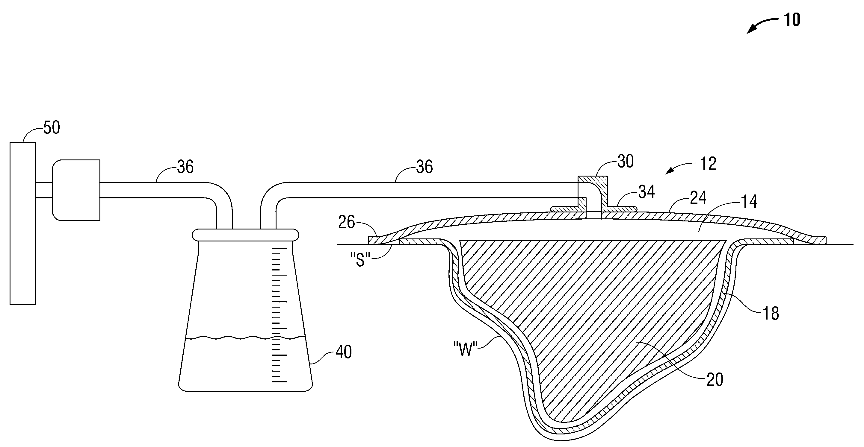 Fibrous Wound Filler Material for Negative Pressure Wound Therapy