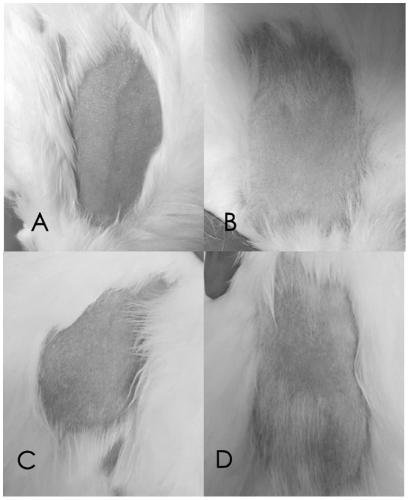 Stretch mark repair preparation containing stem cell exosome as well as preparation method and application of preparation