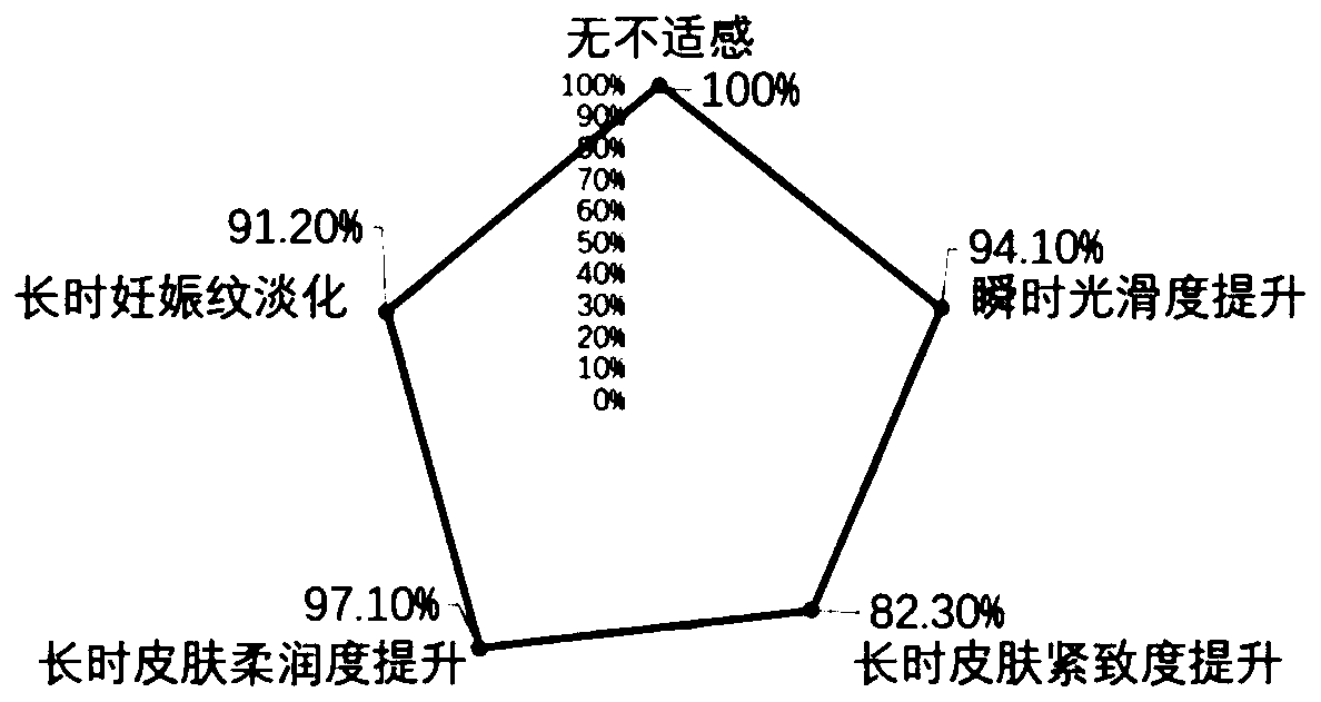 Stretch mark repair preparation containing stem cell exosome as well as preparation method and application of preparation