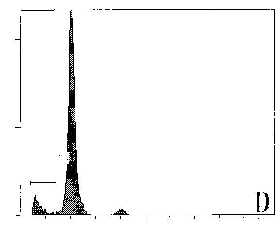 Traditional Chinese medicine for preventing and treating Alzheimer disease and preparation method thereof