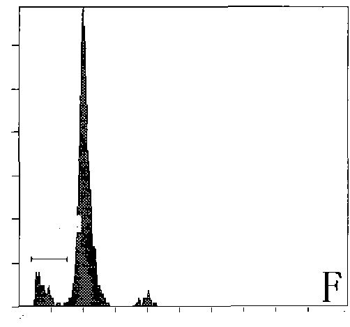 Traditional Chinese medicine for preventing and treating Alzheimer disease and preparation method thereof