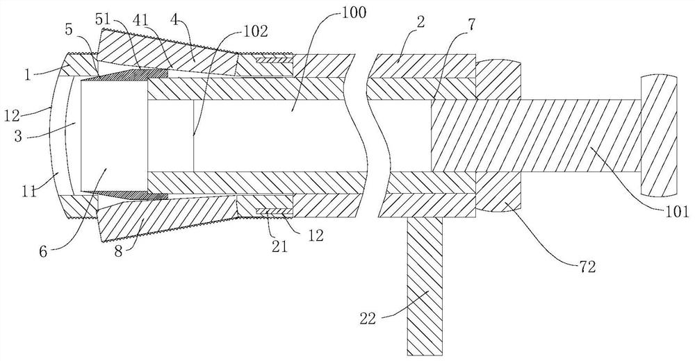 Expandable and recoverable synchronous bone grafting set for intervertebral fusion under percutaneous spine endoscope