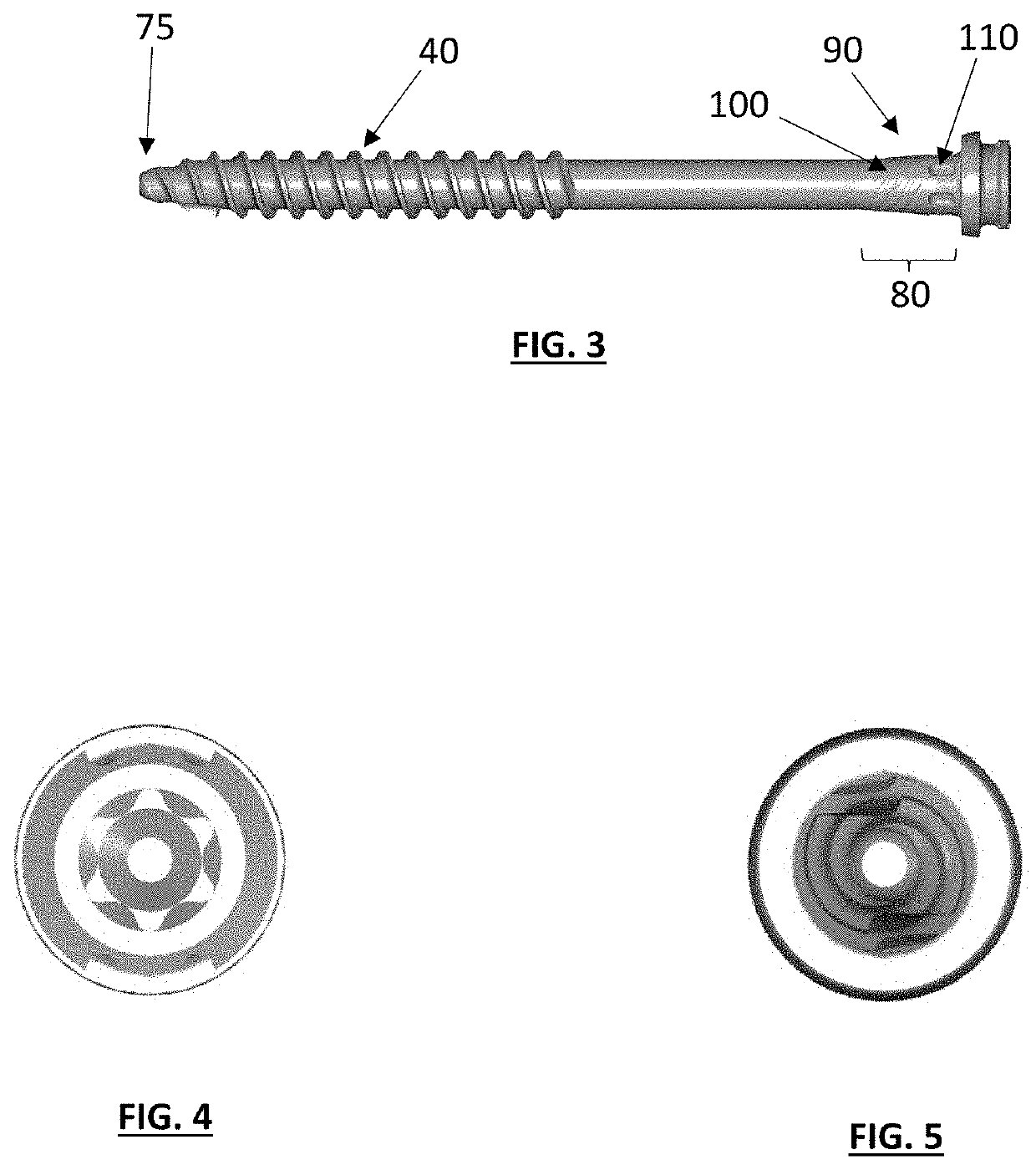 Backout Resistant Screw