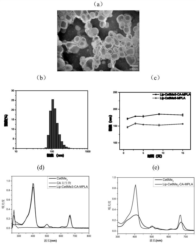 Novel composite nano preparation based on sonodynamic/immune combined therapy and preparation method and application thereof