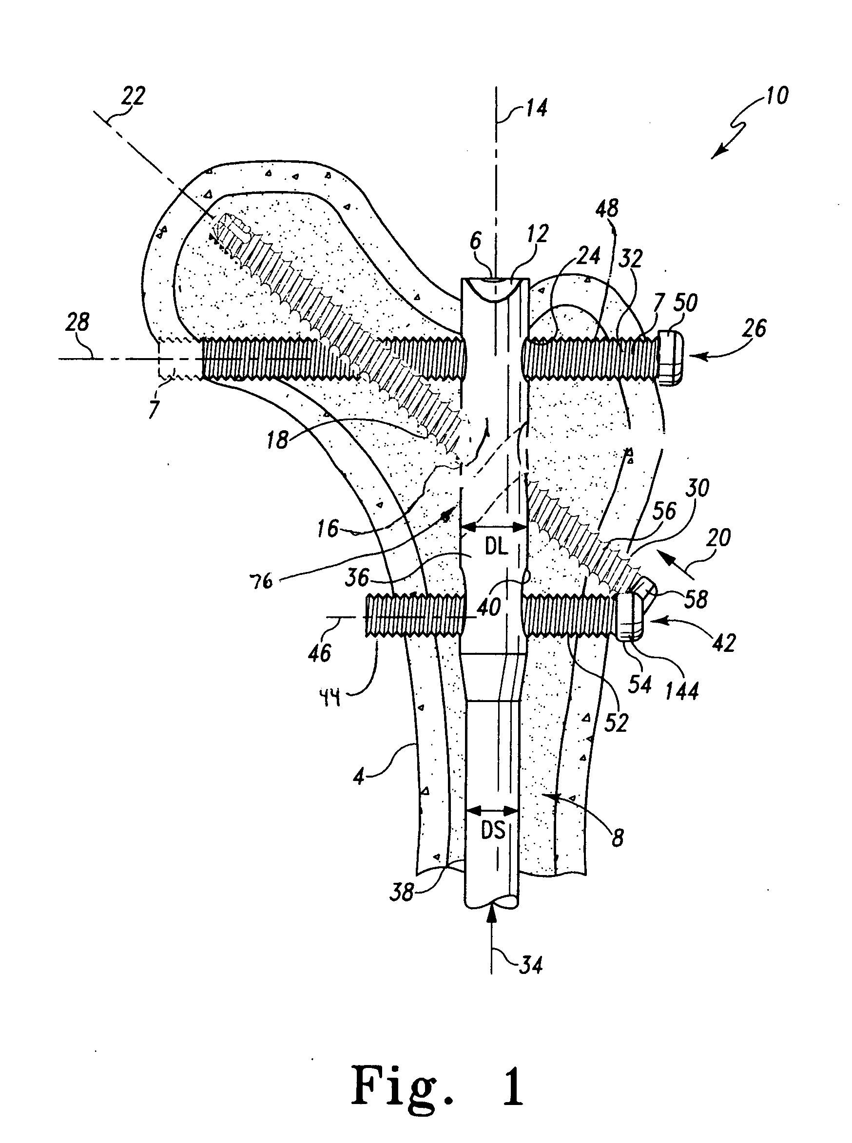 Multiple purpose nail, nail assembly and associated method