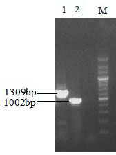 Gene engineering bacterial strain generating succinic acid and method of producing succinic acid by fermentation of the gene engineering bacterial strain