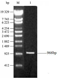 Gene engineering bacterial strain generating succinic acid and method of producing succinic acid by fermentation of the gene engineering bacterial strain