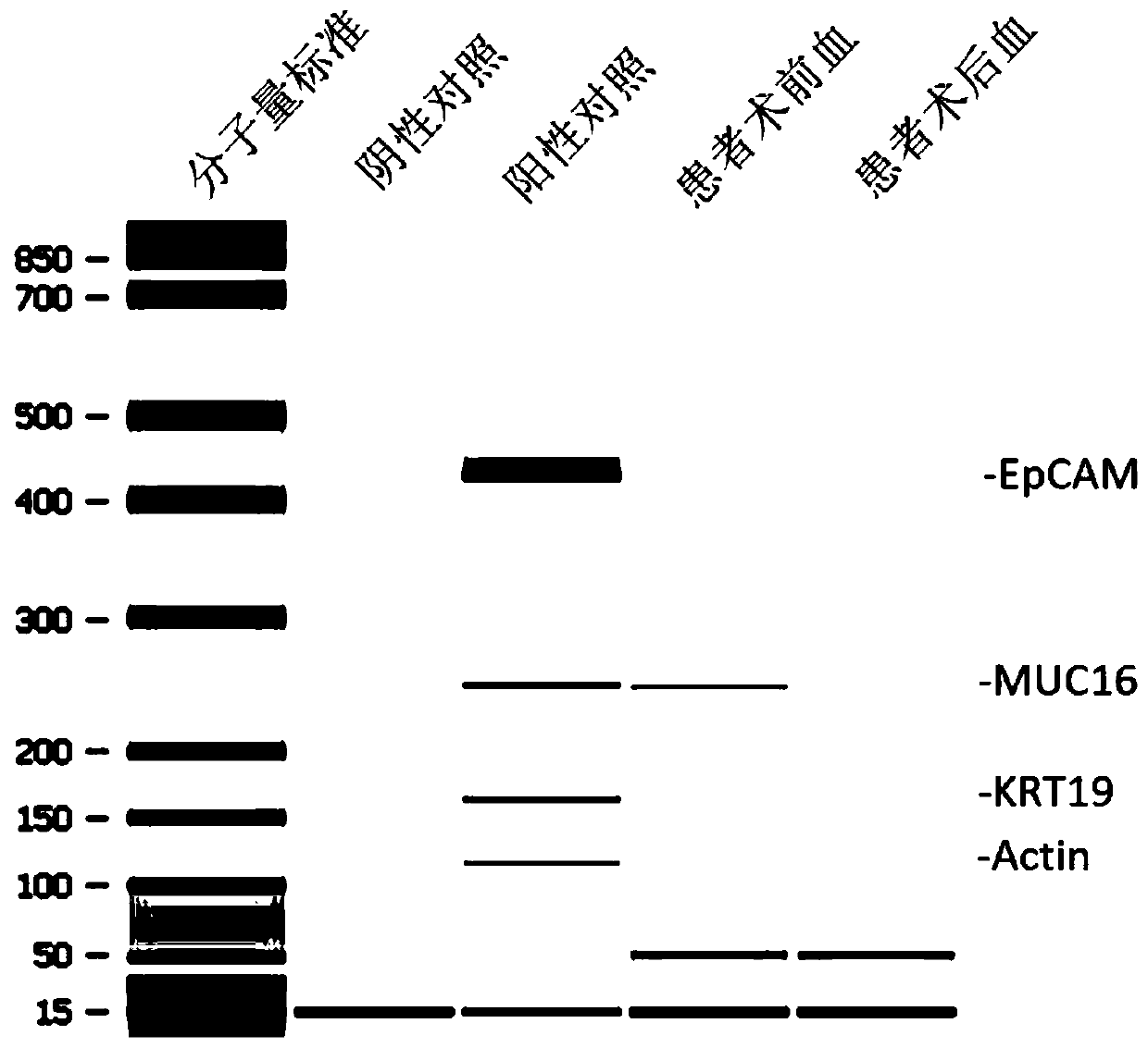 A kit for detecting markers of pancreatic cancer cells in peripheral blood