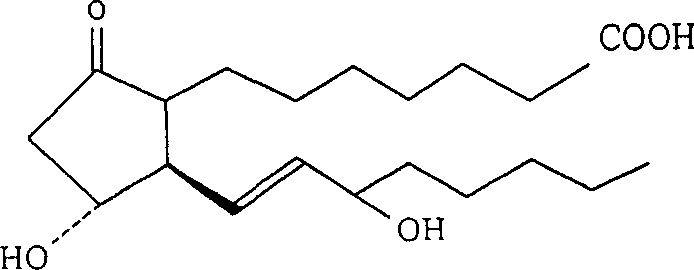 Nano emulsion injection of alprostadil and preparation method