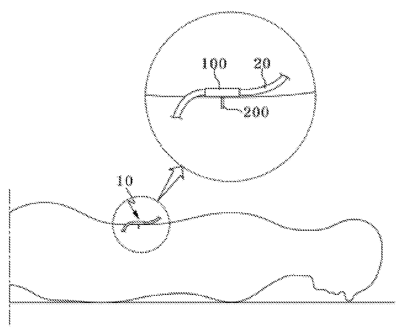 Medical Tube Fixing Apparatus and Medical Tube Fixing Method Using the Same