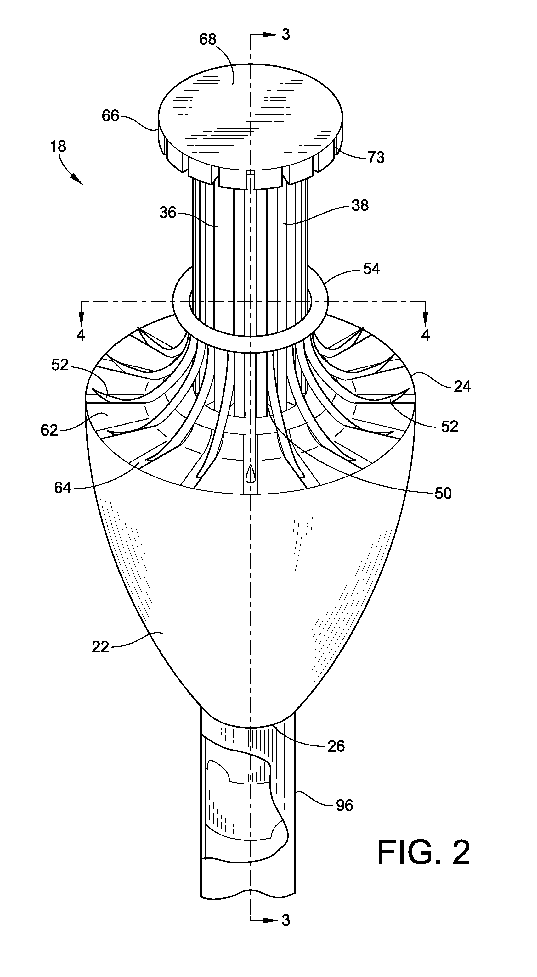 Internal gastric bander for obesity