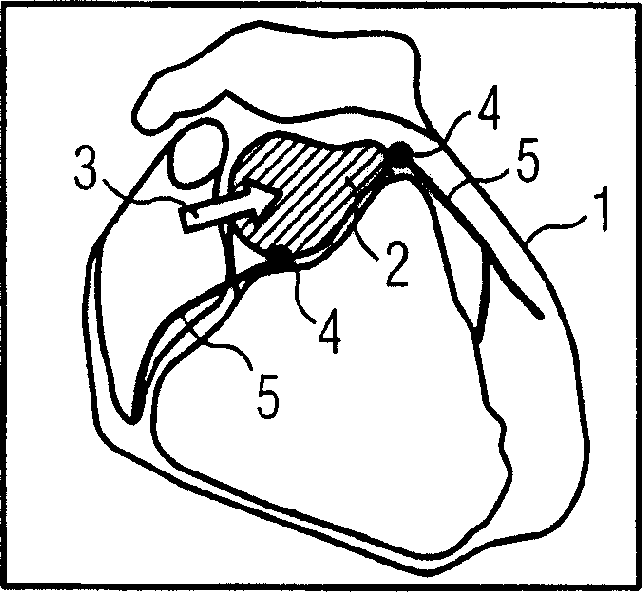 Method for segmenting anatomical structures from 3d image data by using topological information