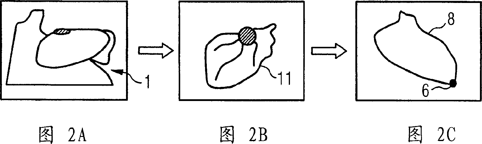 Method for segmenting anatomical structures from 3d image data by using topological information