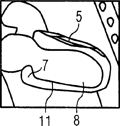 Method for segmenting anatomical structures from 3d image data by using topological information