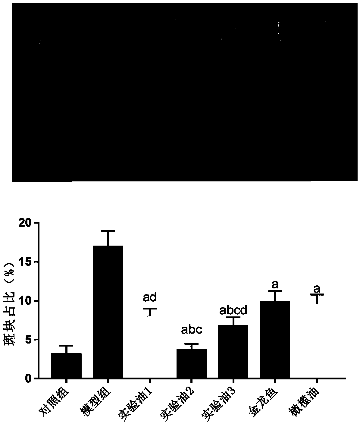 Edible oil with atherosclerosis-preventing effect