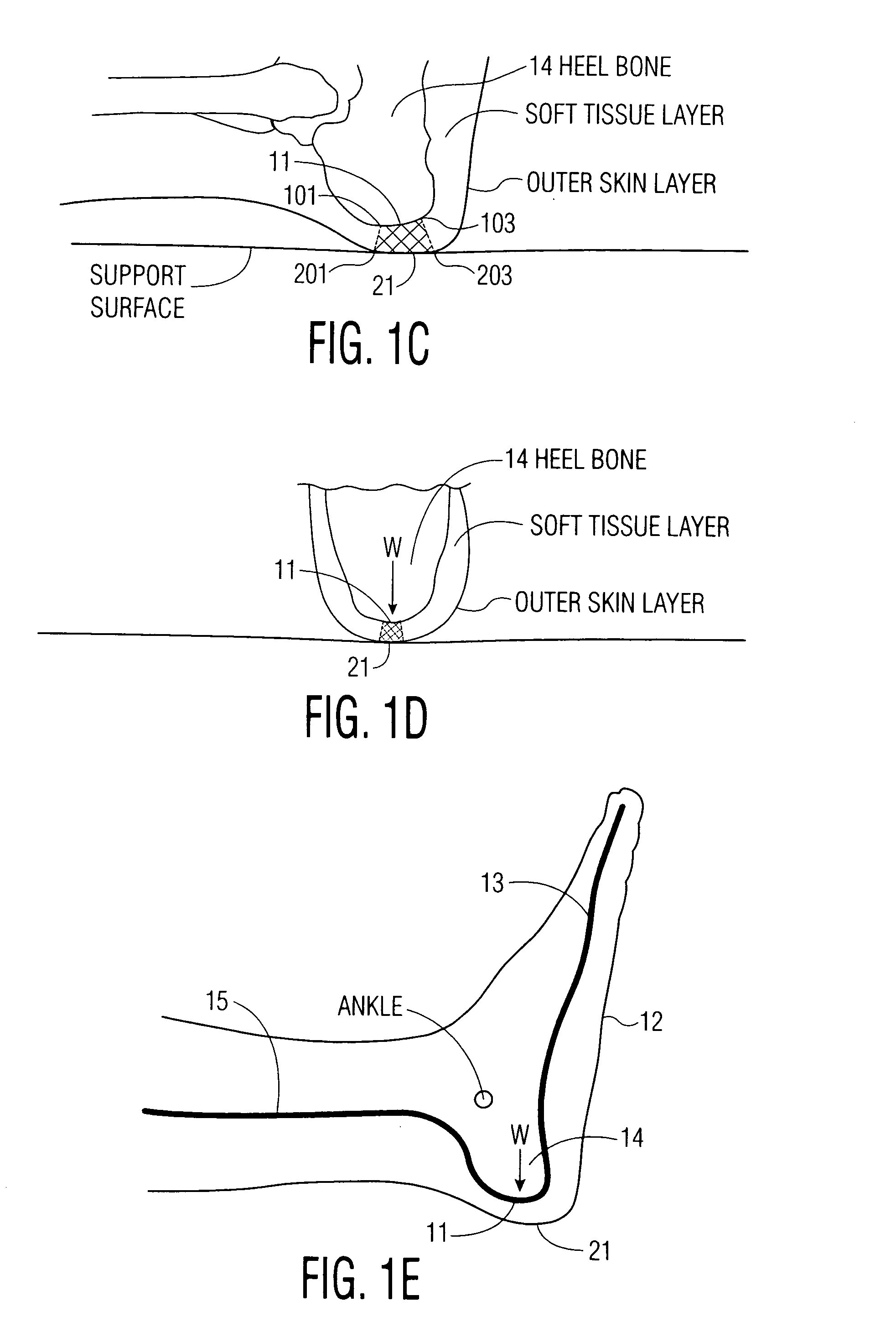 Apparatus and methods for preventing and/or healing pressure ulcers