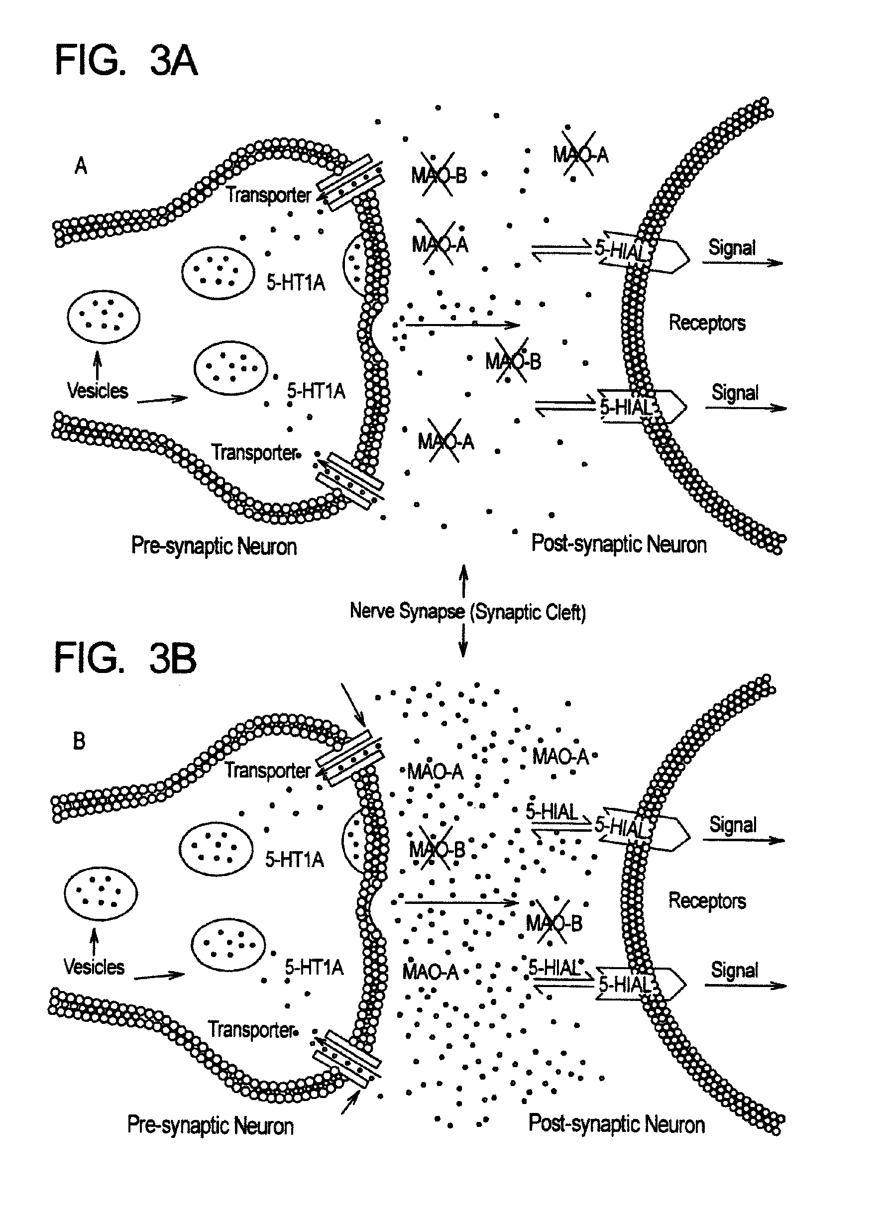 Method for treatment of neurologic dysfunction