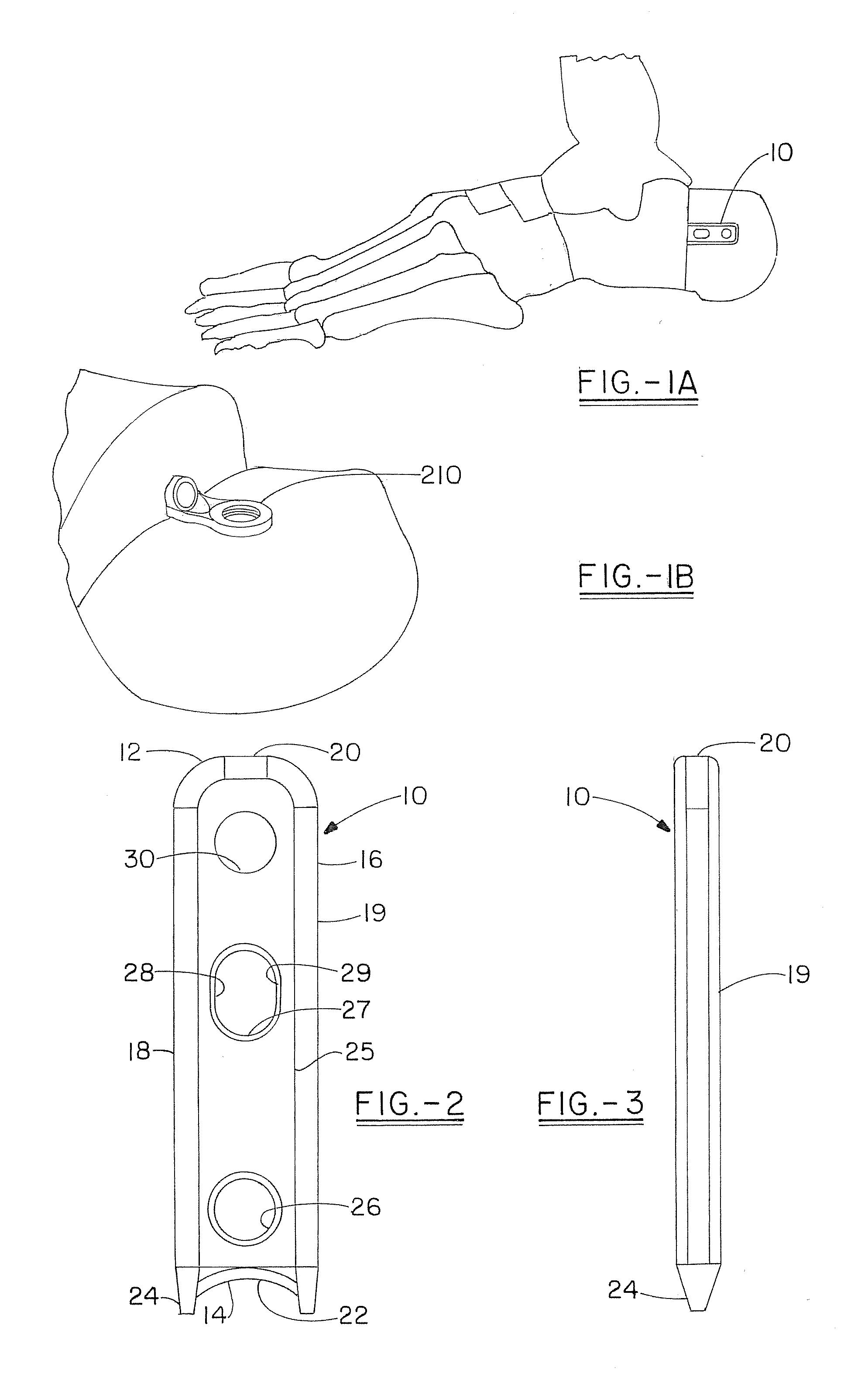 Osteotomy plate, plate driver and method for their use