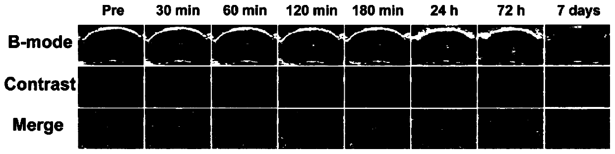 Platelet membrane self-assembly nanobubble, and preparation method and application thereof