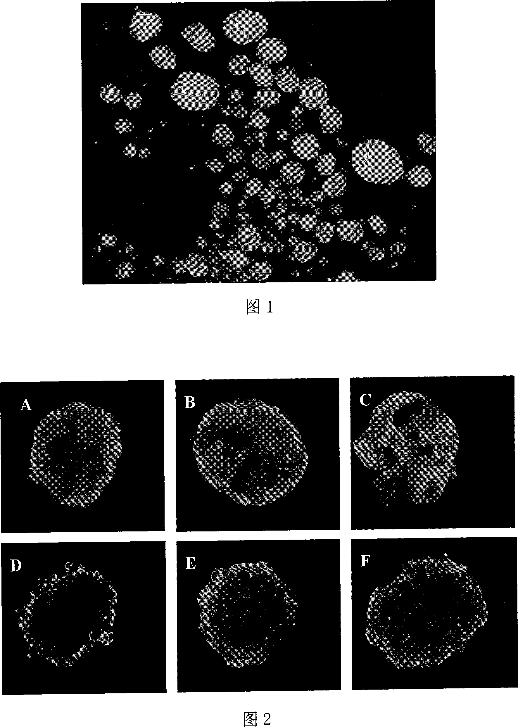 Method for forming pancreatic islet like structure by external evoked stem cell differentiation pancreatic islet cell