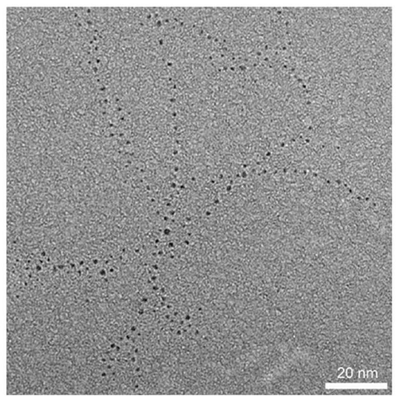 Acetylcysteine-stabilized gold nanocluster for acute kidney injury as well as preparation method and application thereof