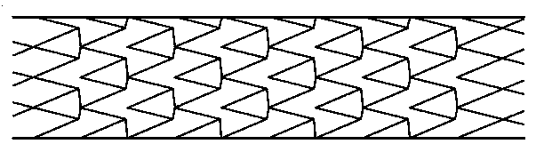 Intravascular stent applied to interventional operation as well as use method, manufacturing method and manufacturing device of intravascular stent