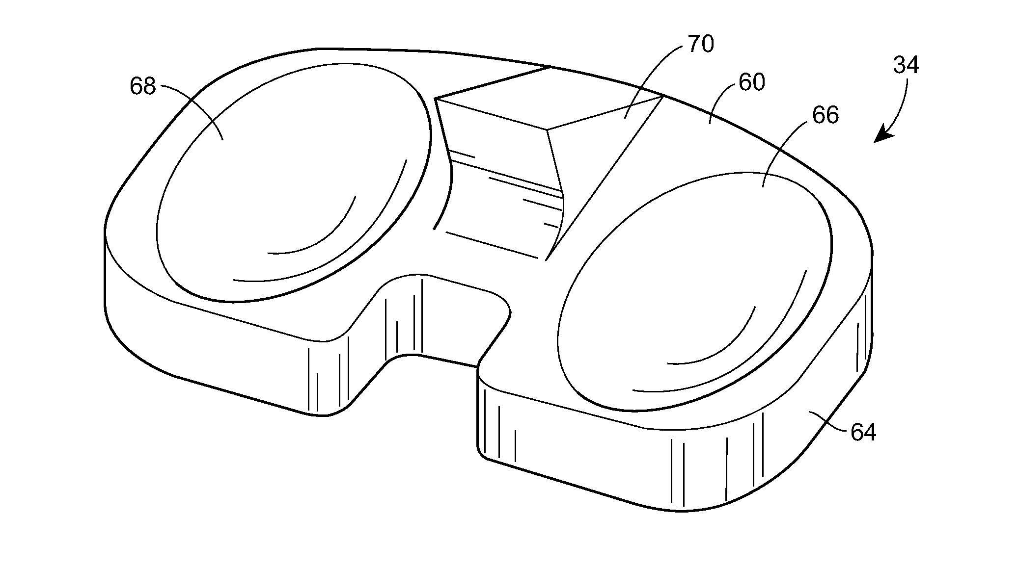 System and method for prosthetic fitting and balancing in joints