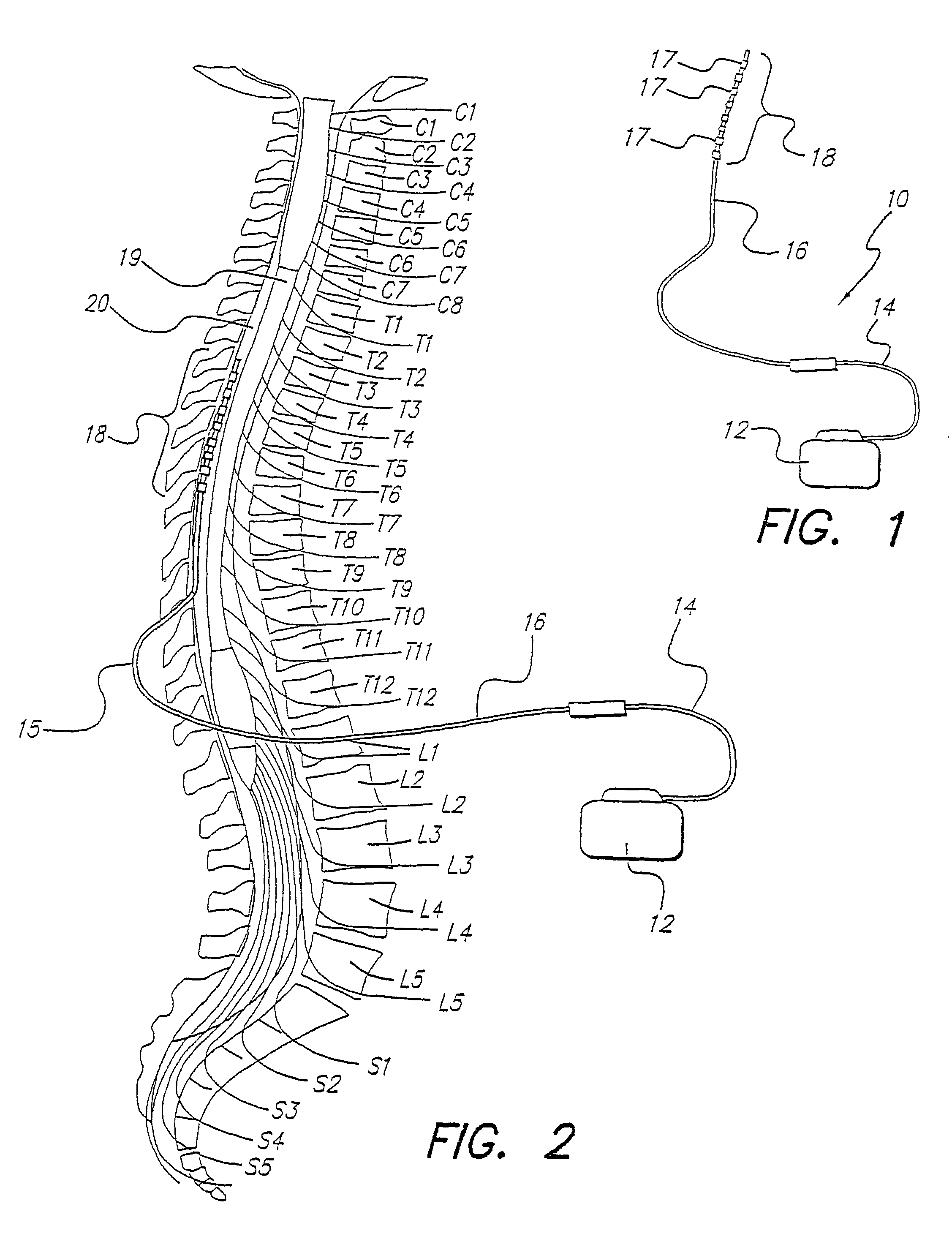 Electrode array assembly and method of making same