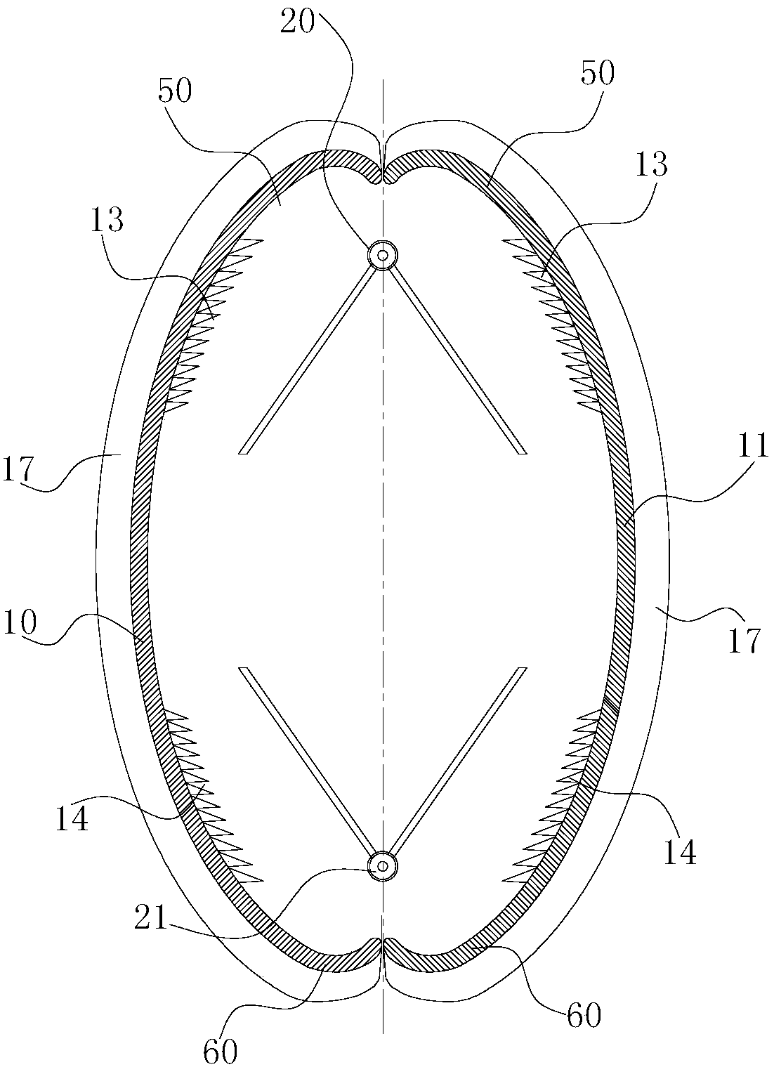 Disc spreader for surgery