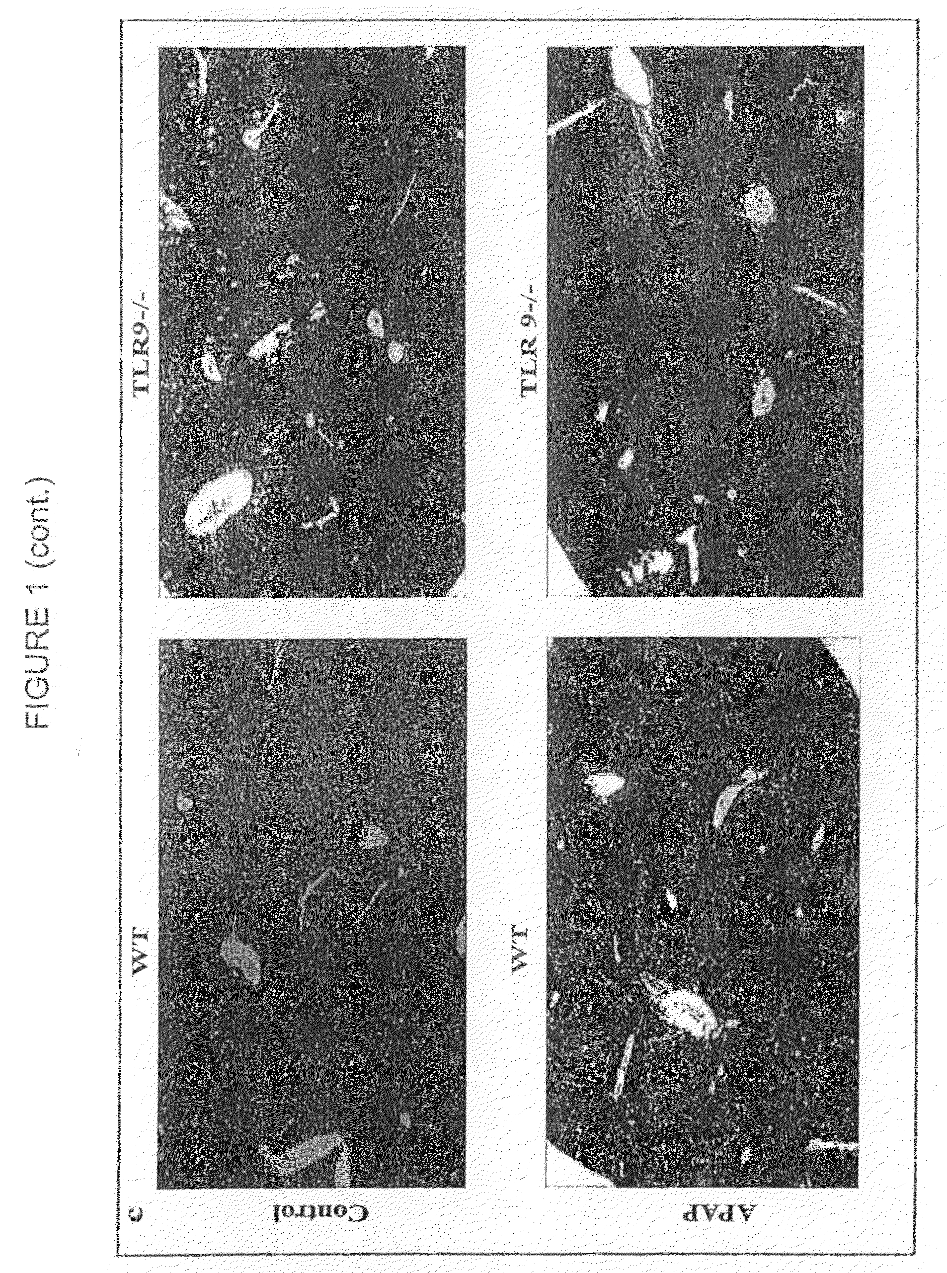 Compositions and methods for reducing hepatotoxicity associated with drug administration and treating non-alcoholic fatty liver disease, non-alcoholic steatohepatitis and associated cirrhosis