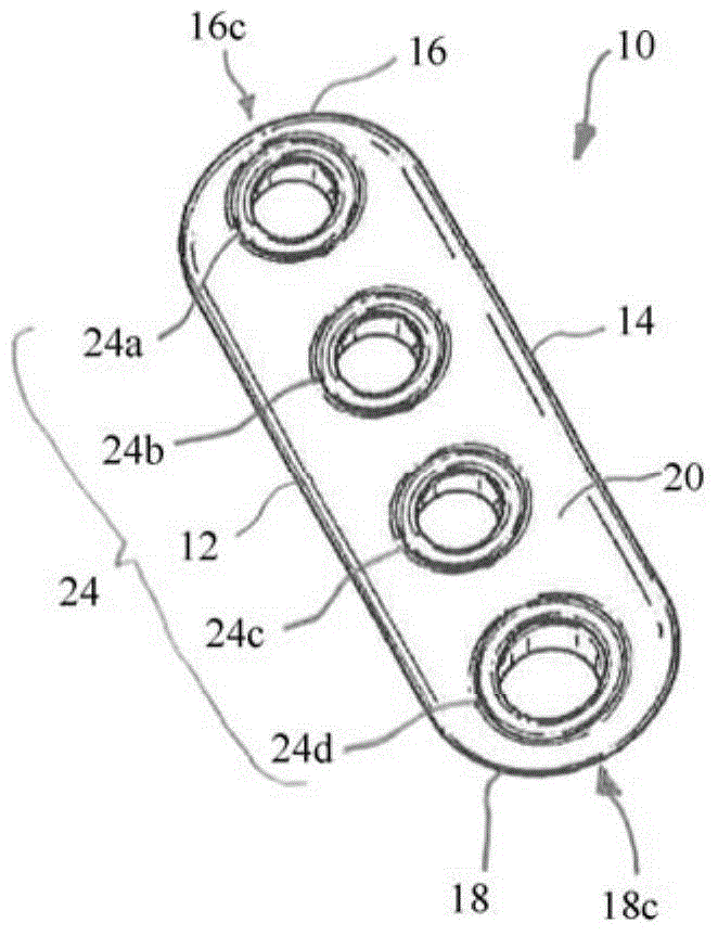 Implant having adjustable filament coils