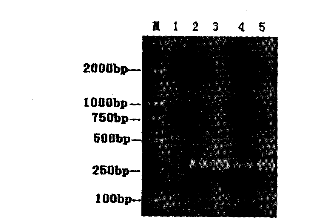 Hippocampus antibiotic peptide pichia pastoris engineering strain and use thereof in breeding