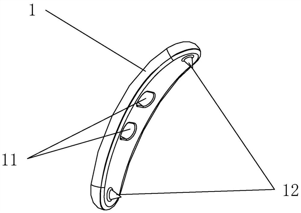 Lesser trochanter bone block belt loop titanium plate and assembly thereof