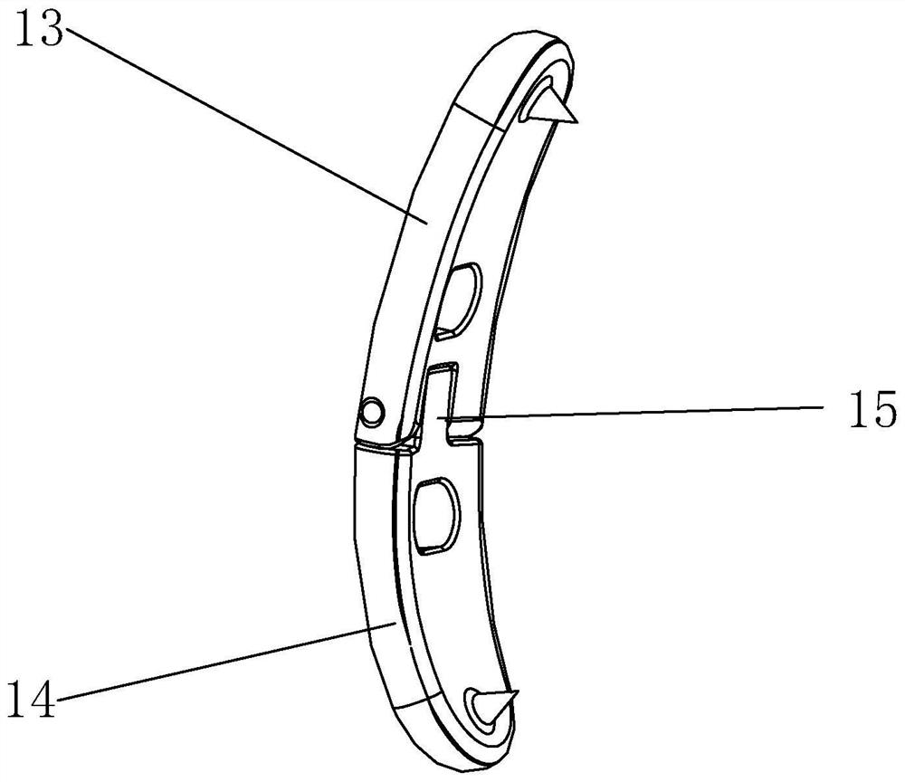 Lesser trochanter bone block belt loop titanium plate and assembly thereof