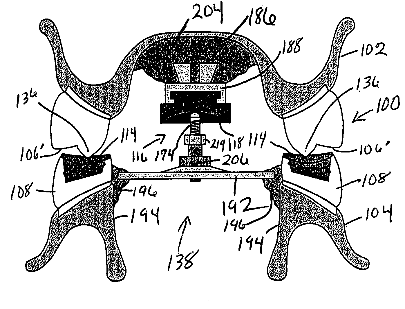 Method for developing balanced occlusion in dentistry