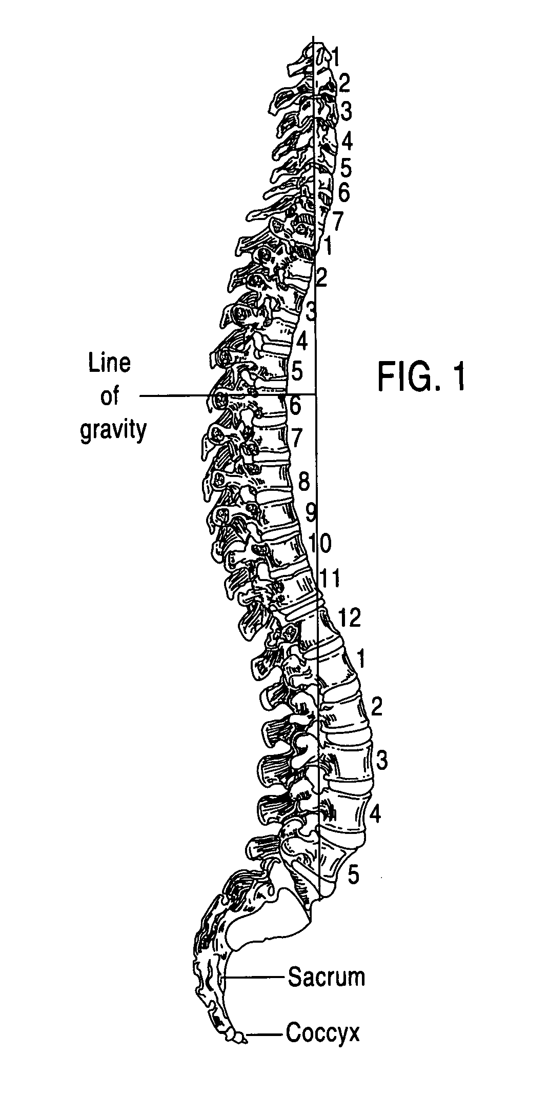 Vertebral disc repair