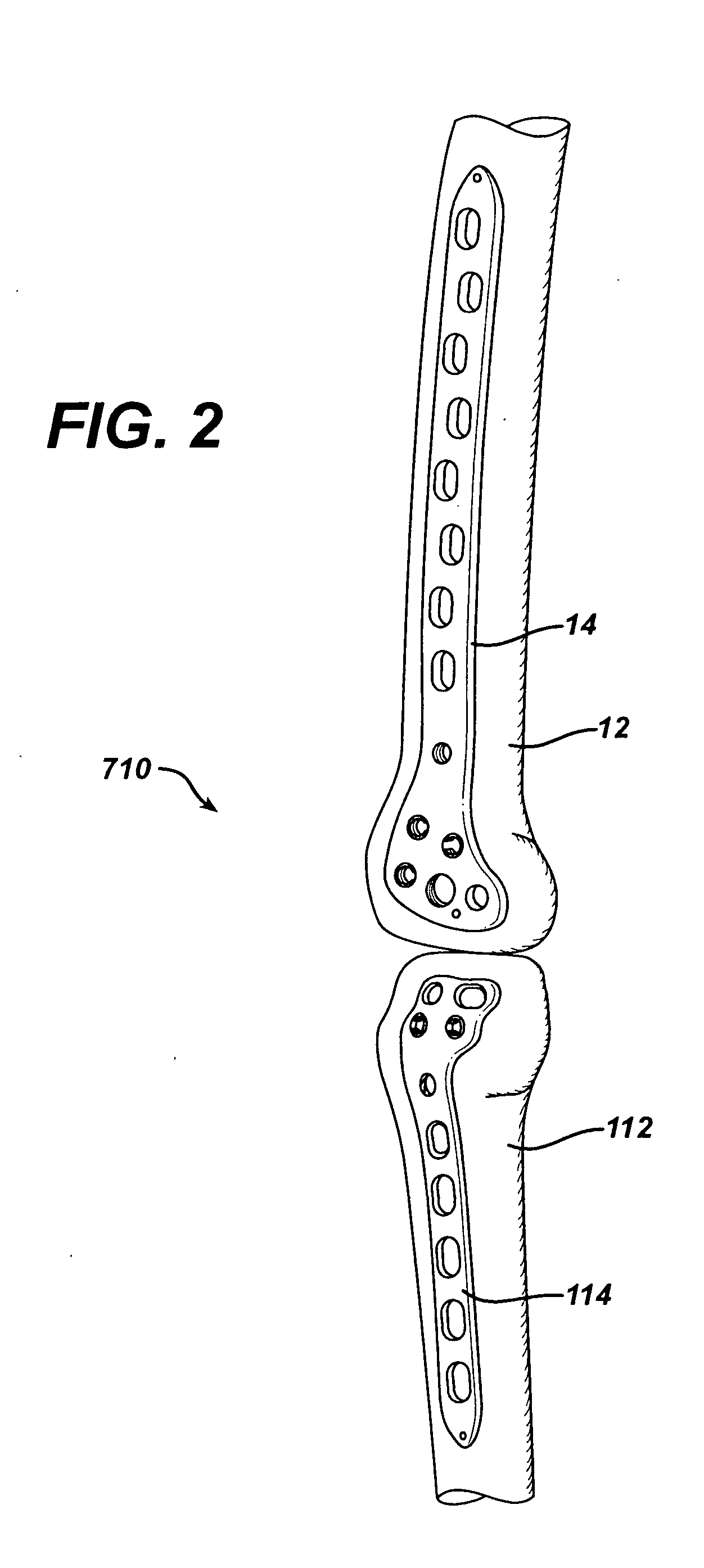 Dual locking plate and associated method