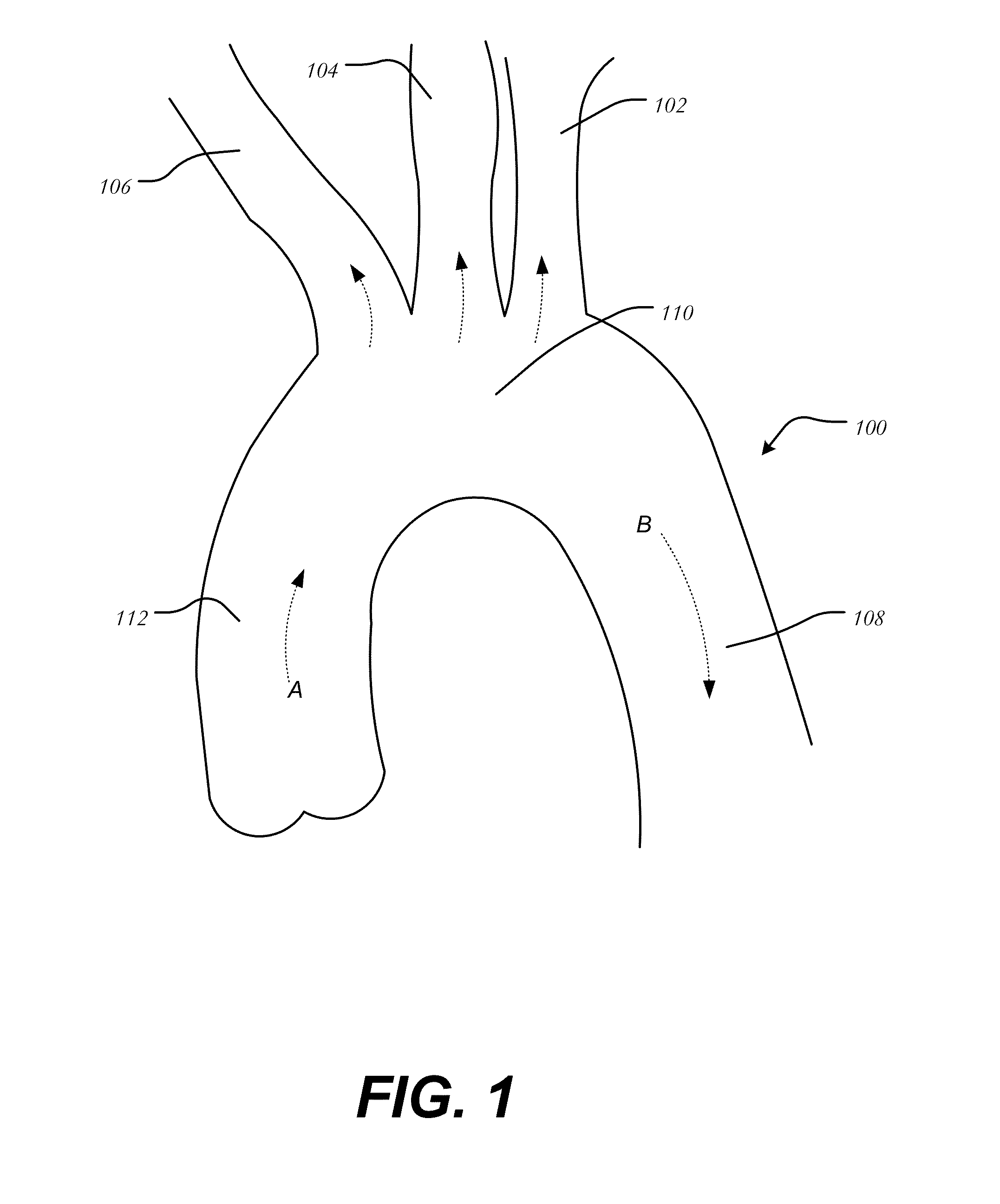 Aortic great vessel protection