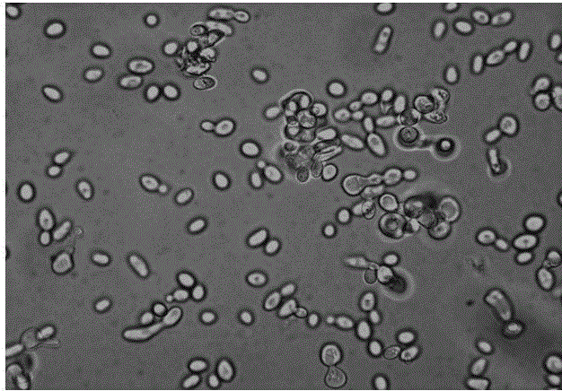 Environmental microorganism zygosaccharomyces bailii