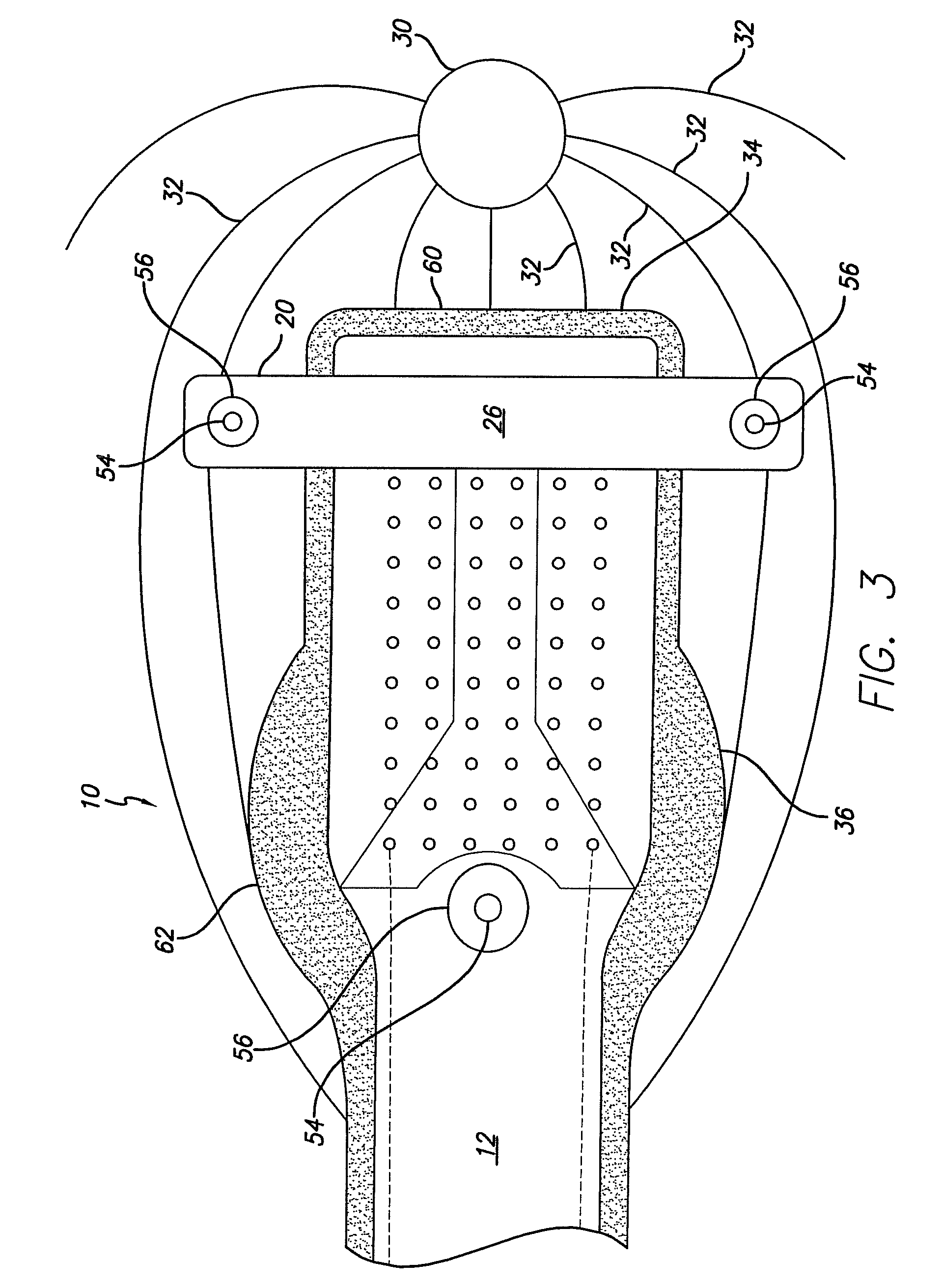 Electrode Array for Even Neural Pressure