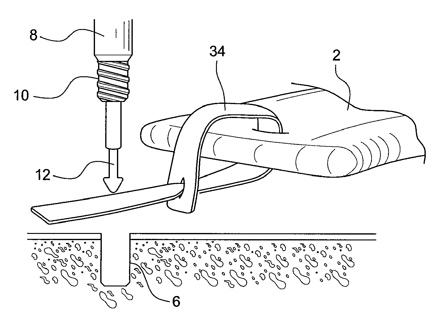 Knotless anchor for surgical repair