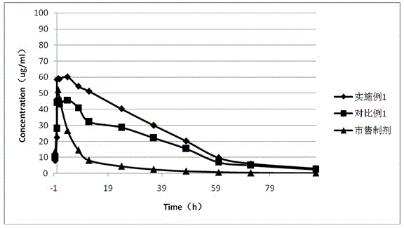 Long-circulating rabeprazole liposome composition and preparation method and application thereof