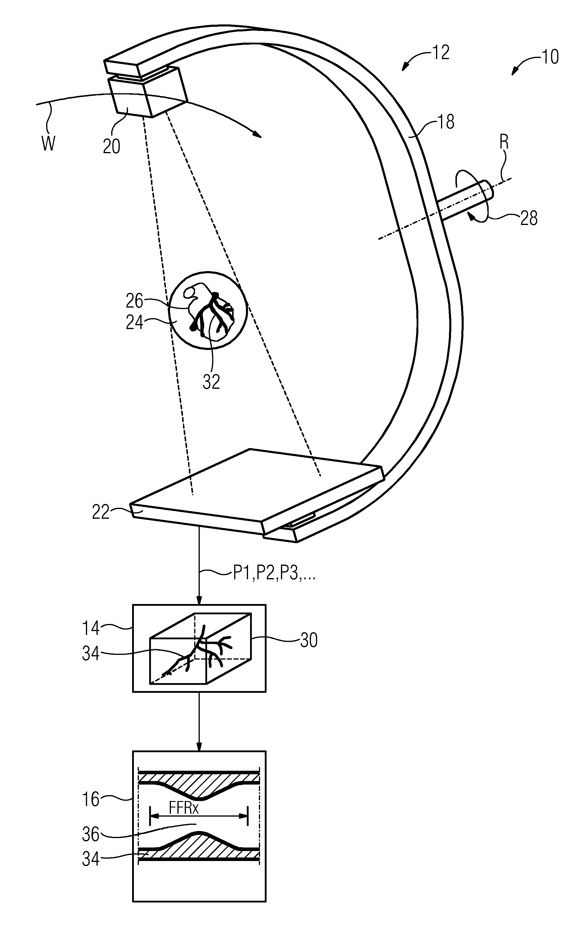 Fluid-dynamic analysis of a vascular tree using angiography